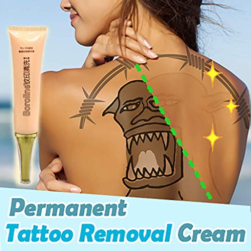 Succeedtop Permanent Tattoo Removal Cream