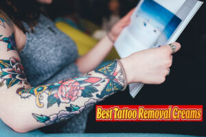 Best Tattoo Removal Creams