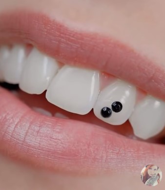 Tooth Piercing or Dental Piercing _5