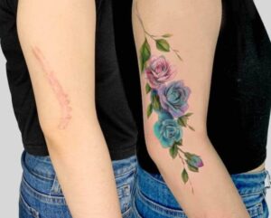 Can You Tattoo Over Scars