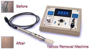 Biotechnique Avance Portable Tattoo Removal Machine